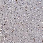 FANCI Antibody in Immunohistochemistry (Paraffin) (IHC (P))