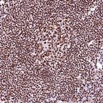 CPSF6 Antibody in Immunohistochemistry (IHC)