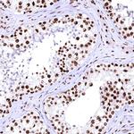 CPSF6 Antibody in Immunohistochemistry (IHC)