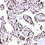 CPSF6 Antibody in Immunohistochemistry (IHC)