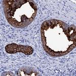 SSFA2 Polyclonal Antibody