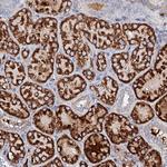 SLC10A7 Antibody in Immunohistochemistry (Paraffin) (IHC (P))