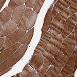 SLC10A7 Antibody in Immunohistochemistry (Paraffin) (IHC (P))