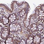 CAPS2 Antibody in Immunohistochemistry (Paraffin) (IHC (P))