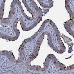 WDR66 Antibody in Immunohistochemistry (Paraffin) (IHC (P))