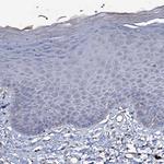 WDR66 Antibody in Immunohistochemistry (Paraffin) (IHC (P))