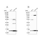 TRMT112 Antibody in Western Blot (WB)