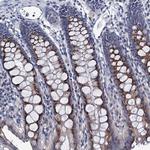 ANKRD33 Polyclonal Antibody