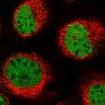 PDS5B Polyclonal Antibody