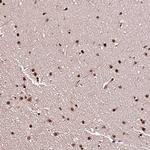 PDS5B Antibody in Immunohistochemistry (Paraffin) (IHC (P))