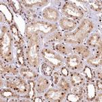 PDS5B Antibody in Immunohistochemistry (Paraffin) (IHC (P))