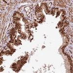 PDS5B Antibody in Immunohistochemistry (Paraffin) (IHC (P))