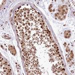 PDS5B Antibody in Immunohistochemistry (Paraffin) (IHC (P))