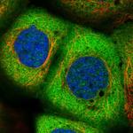 NARS Polyclonal Antibody