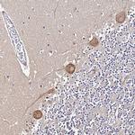 NARS Antibody in Immunohistochemistry (IHC)