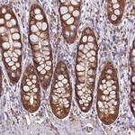 NARS Antibody in Immunohistochemistry (IHC)