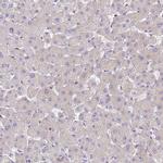 NARS Antibody in Immunohistochemistry (IHC)