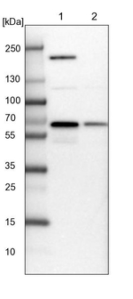 NARS Antibody in Western Blot (WB)