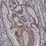 SH2D4B Polyclonal Antibody