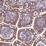 FAM186B Antibody in Immunohistochemistry (Paraffin) (IHC (P))