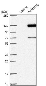 FAM186B Antibody in Western Blot (WB)