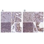 MPP8 Antibody in Immunohistochemistry (IHC)