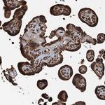 TCTN1 Antibody in Immunohistochemistry (Paraffin) (IHC (P))