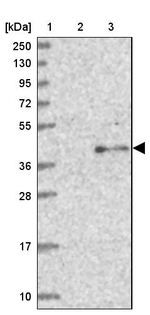 TCTN1 Antibody in Western Blot (WB)