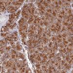 WBP11 Antibody in Immunohistochemistry (Paraffin) (IHC (P))