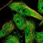 KIAA1468 Polyclonal Antibody