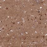 KIAA1468 Antibody in Immunohistochemistry (Paraffin) (IHC (P))