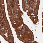 KIAA1468 Antibody in Immunohistochemistry (Paraffin) (IHC (P))
