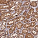 KIAA1468 Antibody in Immunohistochemistry (Paraffin) (IHC (P))