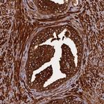 KIAA1468 Antibody in Immunohistochemistry (Paraffin) (IHC (P))