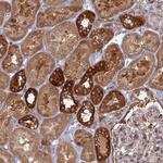 TBC1D30 Polyclonal Antibody