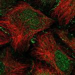 SPERT Polyclonal Antibody