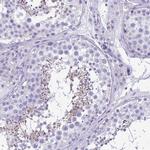 SPERT Antibody in Immunohistochemistry (IHC)