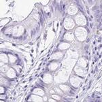 SPERT Antibody in Immunohistochemistry (IHC)