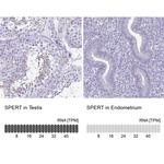 SPERT Antibody