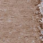 C11orf49 Antibody in Immunohistochemistry (Paraffin) (IHC (P))