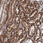 C11orf49 Antibody in Immunohistochemistry (Paraffin) (IHC (P))