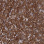 C11orf49 Polyclonal Antibody