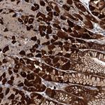 C11orf49 Antibody in Immunohistochemistry (Paraffin) (IHC (P))