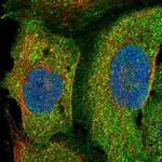 PLEKHO2 Polyclonal Antibody