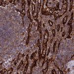 PLEKHO2 Antibody in Immunohistochemistry (IHC)
