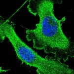 CCDC123 Polyclonal Antibody