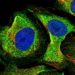 NDUFAF1 Antibody in Immunocytochemistry (ICC/IF)