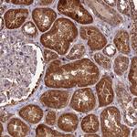 NDUFAF1 Antibody in Immunohistochemistry (Paraffin) (IHC (P))