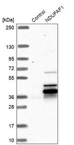 NDUFAF1 Antibody in Western Blot (WB)