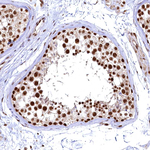 RSRC2 Antibody in Immunohistochemistry (Paraffin) (IHC (P))